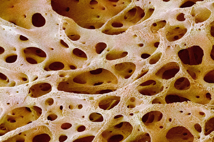 Израильские медики вырастили костную ткань из жировых клеток